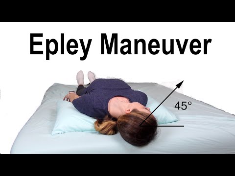 epley maneuver video