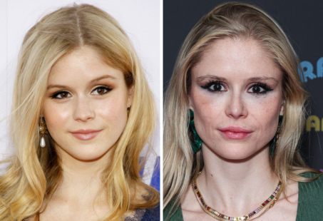 did erin moriarty get plastic surgery