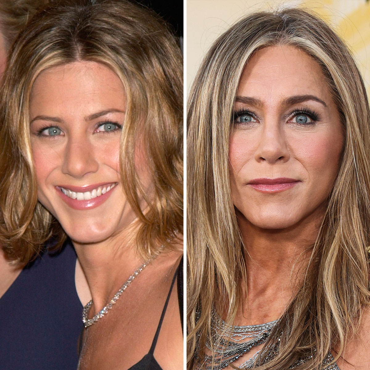 jennifer aniston plastic surgery