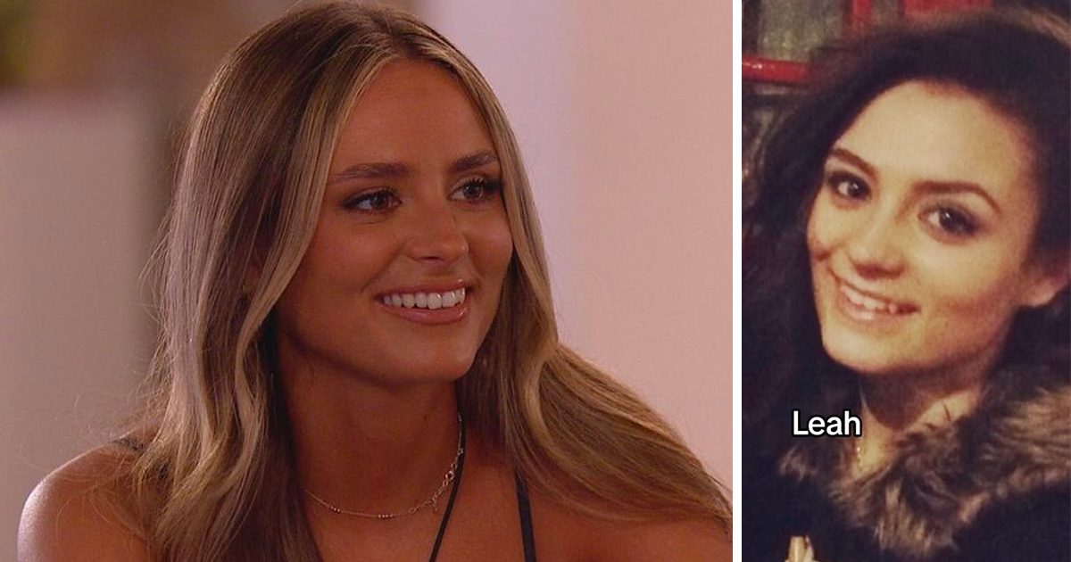 leah love island usa plastic surgery