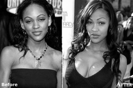 megan good plastic surgery