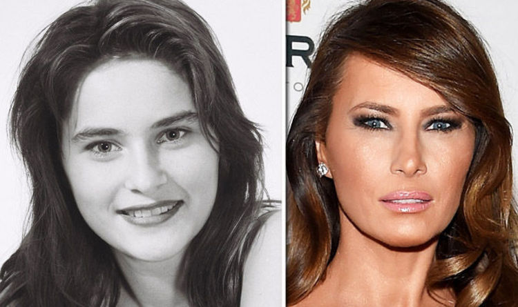 melania trump plastic surgery