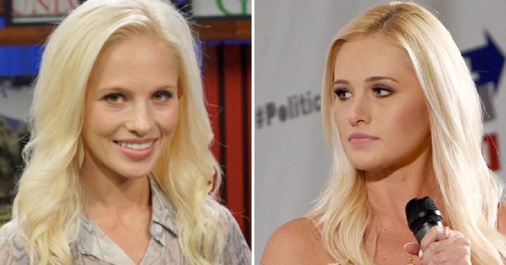 tomi lahren nose job